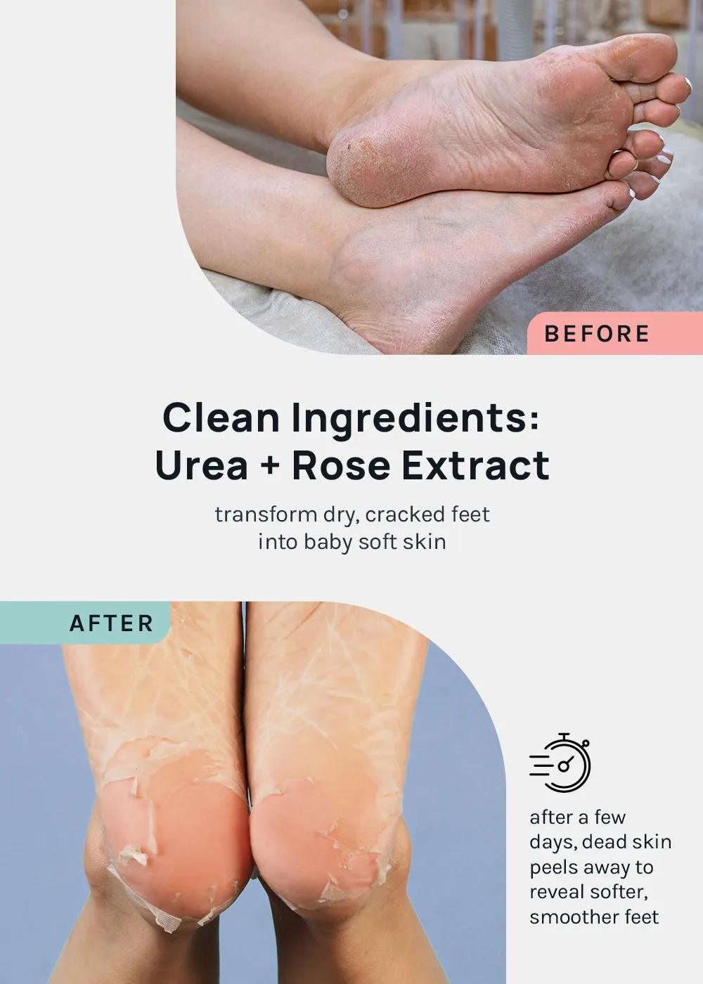 AOA Skin Foot Peeling Masks