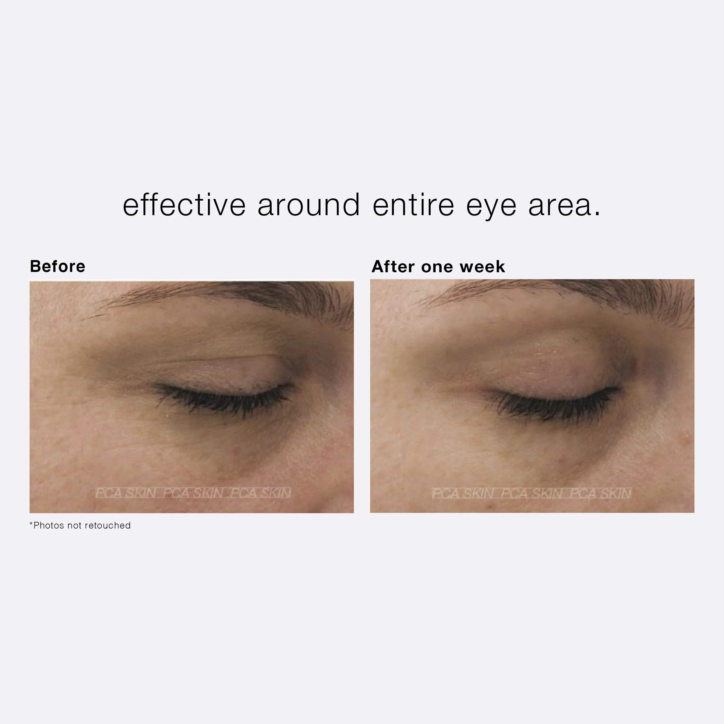 PCA SKIN Ideal Complex Restorative Eye Cream - Anti-Aging Brightening Eye Treatment for Dark Circles, Puffiness, Fine Lines & Wrinkles (0.5 oz)